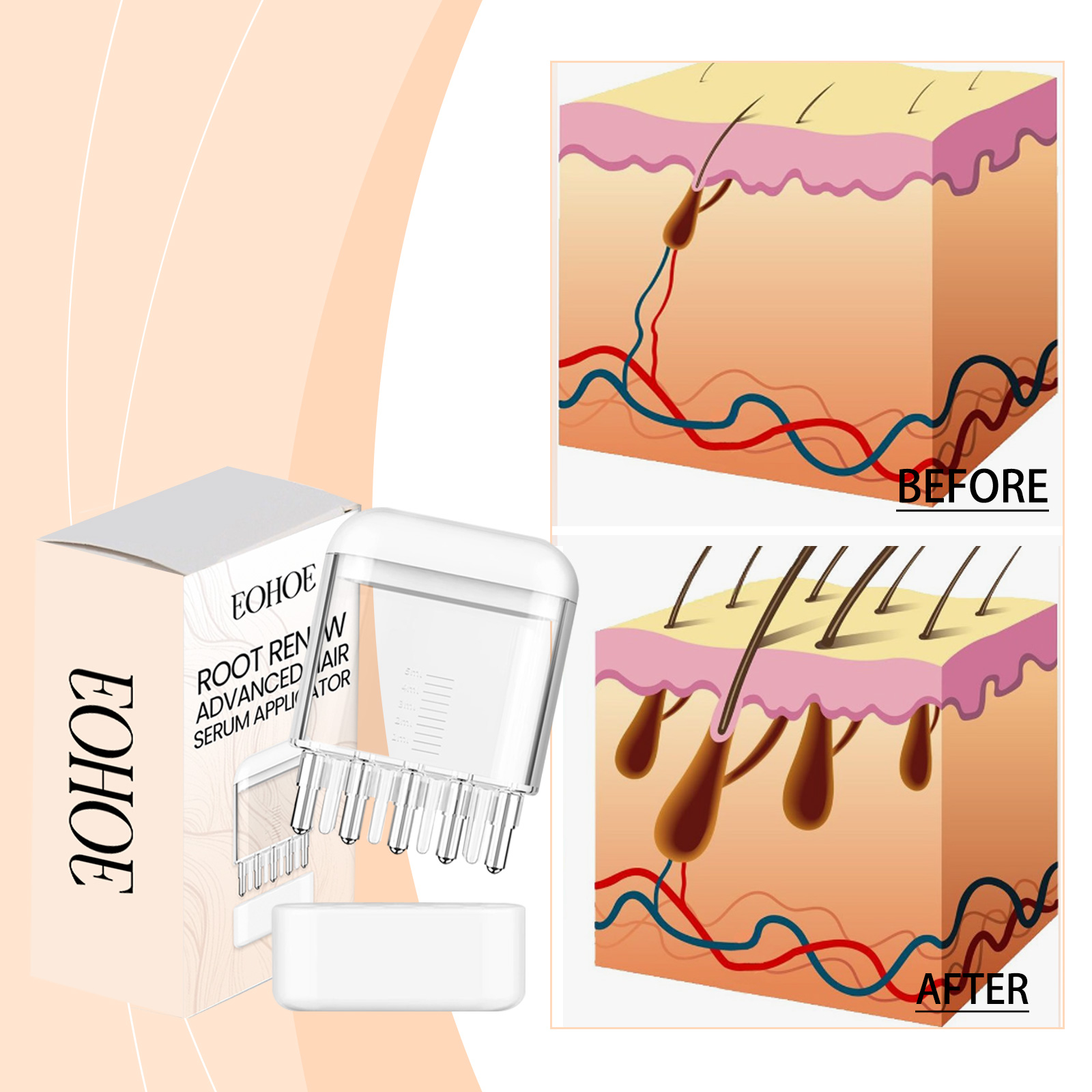 Root Renewal Hair Scalp Applicator – Precision Liquid & Oil Massager Comb for Hair Growth (1pc)